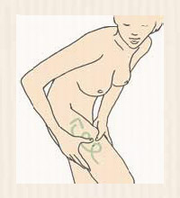 Reshaped buttocks and thighs
